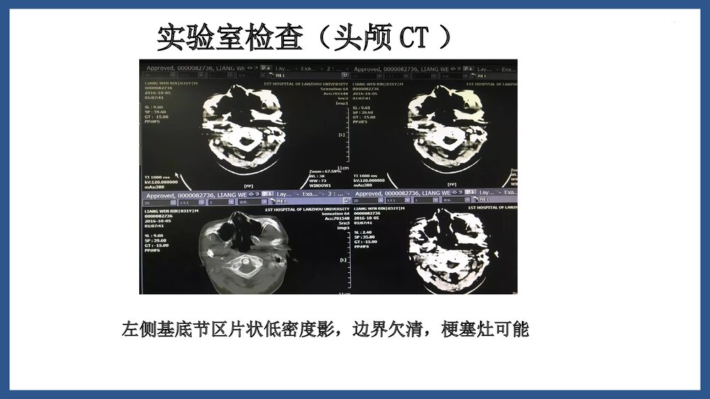 高热危象护理查房PPT课件下载7