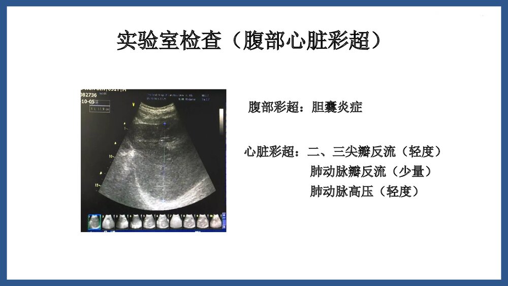 高热危象护理查房PPT课件下载9