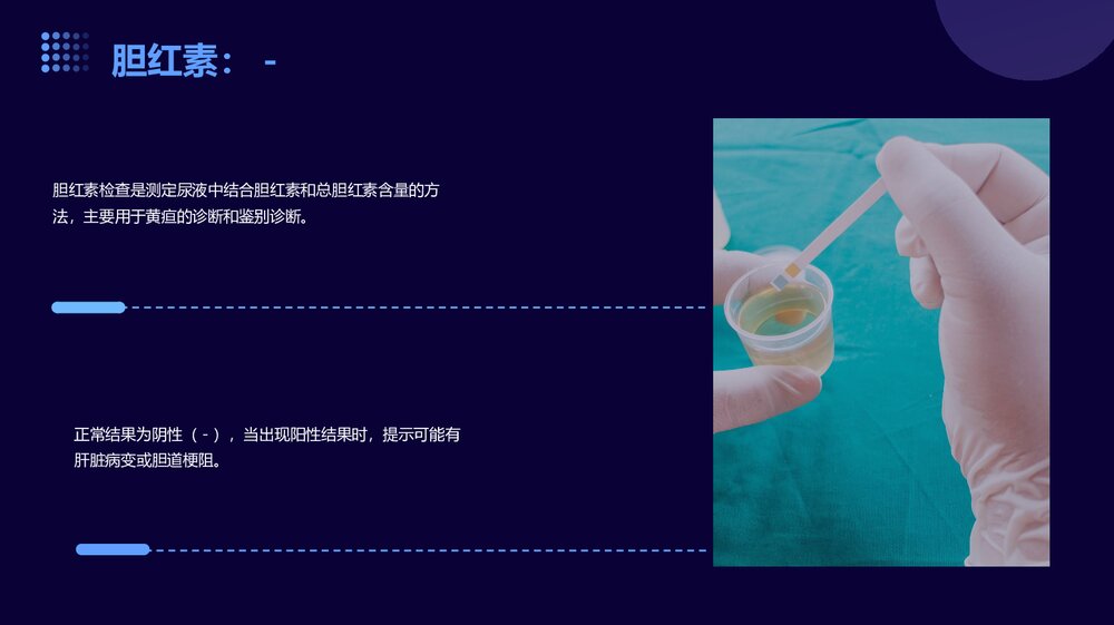 检验科正常值尿液血常规生化发光PPT课件8