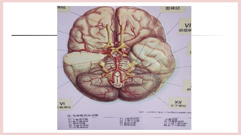 (神经内科)TIA患者的护理PPT课件下载4