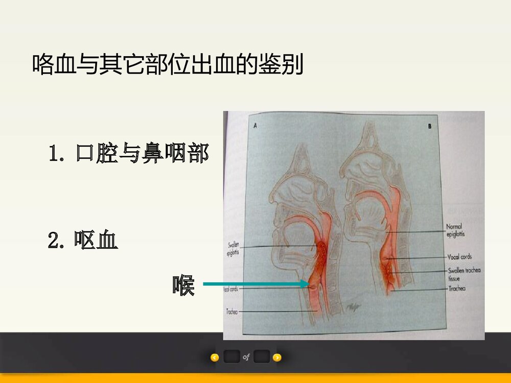 咯血PPT课件下载3