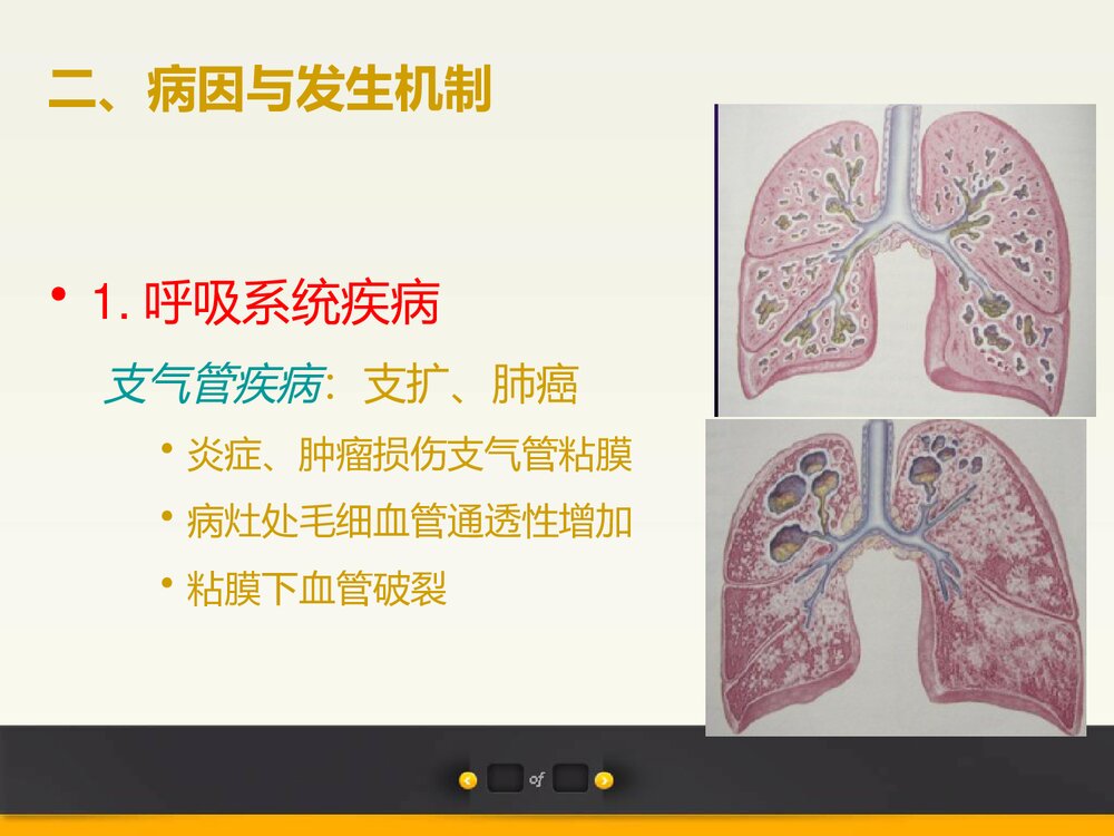 咯血PPT课件下载9