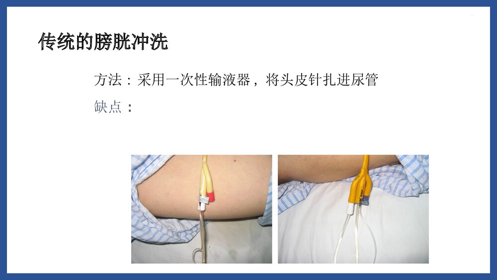 膀胱冲洗PPT课件下载5