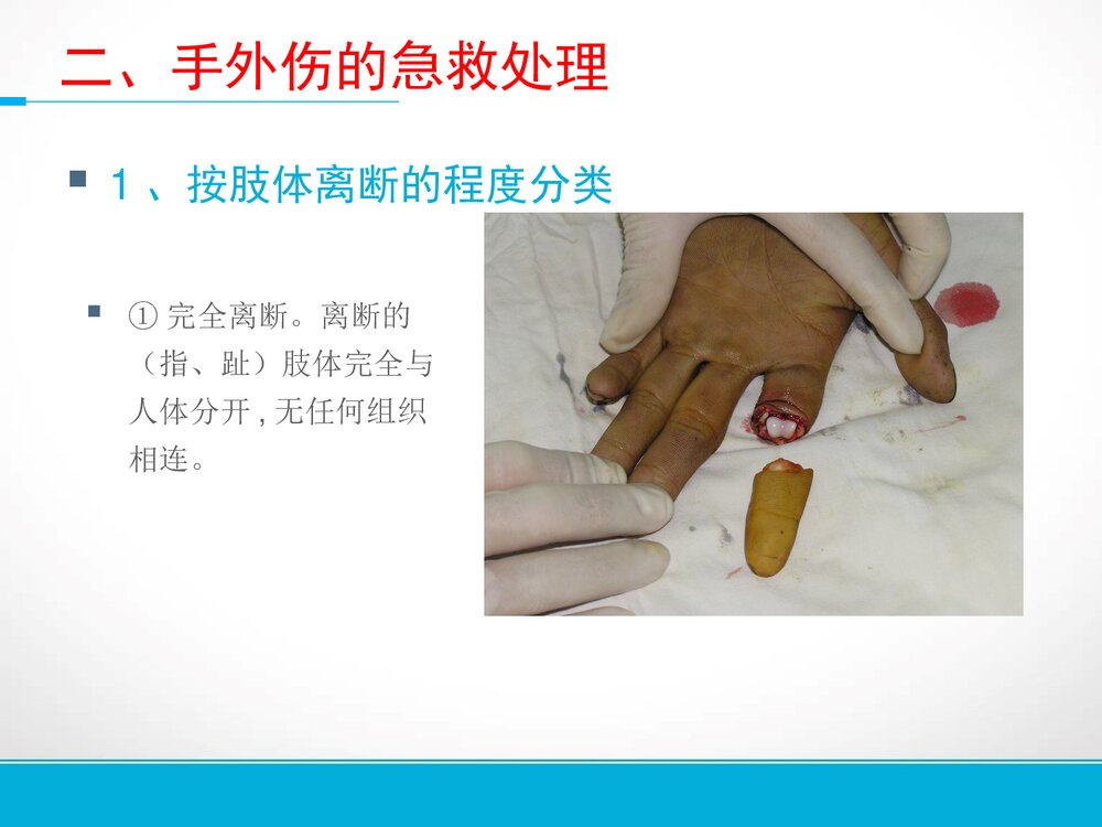 手部外伤的的护理PPT课件下载6