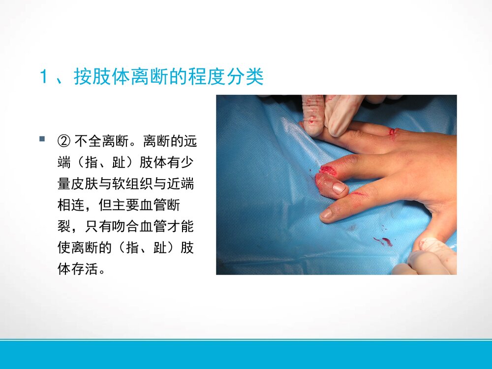 手部外伤的的护理PPT课件下载7