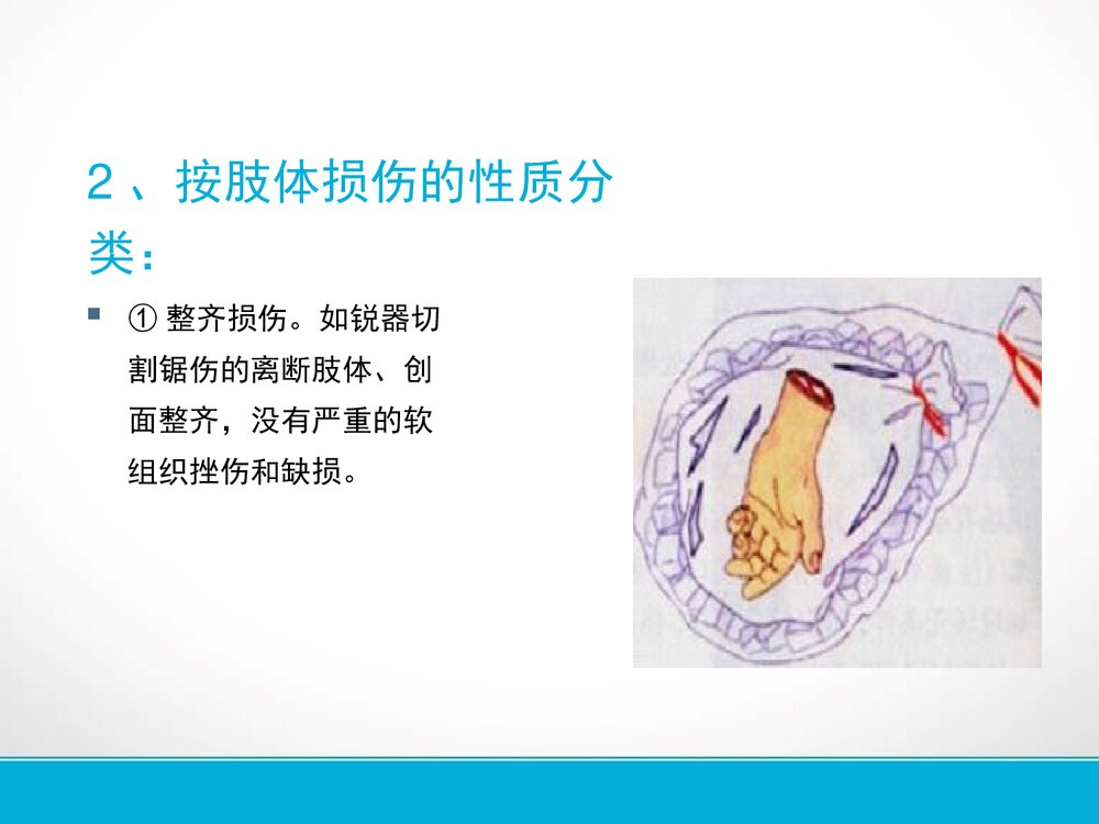 手部外伤的的护理PPT课件下载8