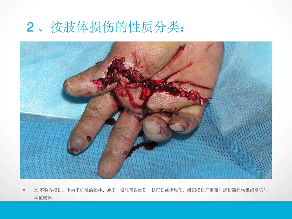 手部外伤的的护理PPT课件下载9