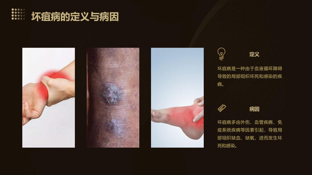 坏疽病中医护理方案PPT课件下载4