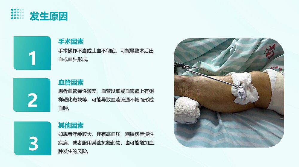 动静脉内瘘血肿处理PPT课件5