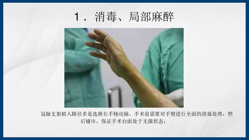 冠脉造影及支架介入术PPT课件下载（共43页·内容可编辑修改）4