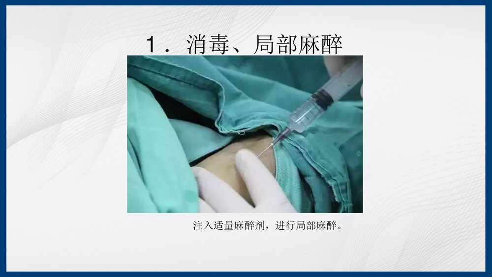 冠脉造影及支架介入术PPT课件下载（共43页·内容可编辑修改）5