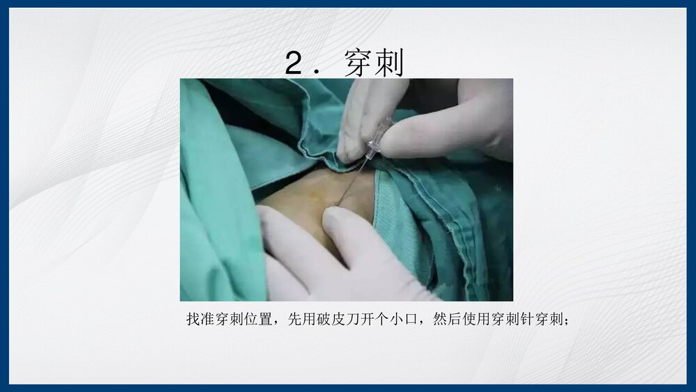 冠脉造影及支架介入术PPT课件下载（共43页·内容可编辑修改）6