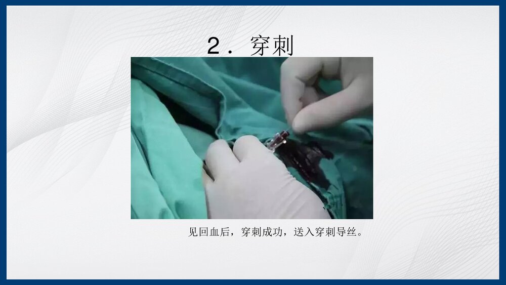 冠脉造影及支架介入术PPT课件下载（共43页·内容可编辑修改）7