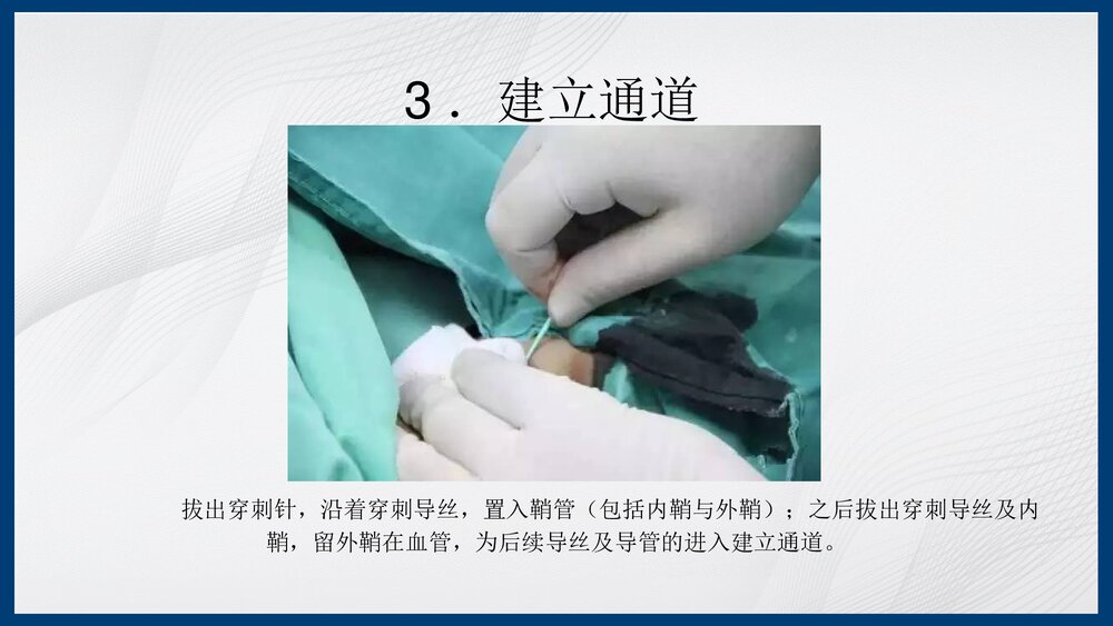 冠脉造影及支架介入术PPT课件下载（共43页·内容可编辑修改）8