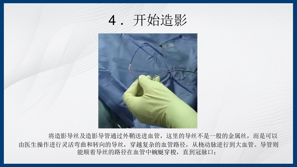 冠脉造影及支架介入术PPT课件下载（共43页·内容可编辑修改）9