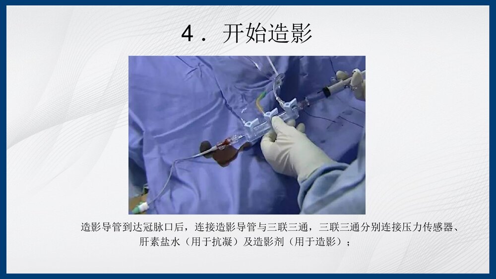 冠脉造影及支架介入术PPT课件下载（共43页·内容可编辑修改）10
