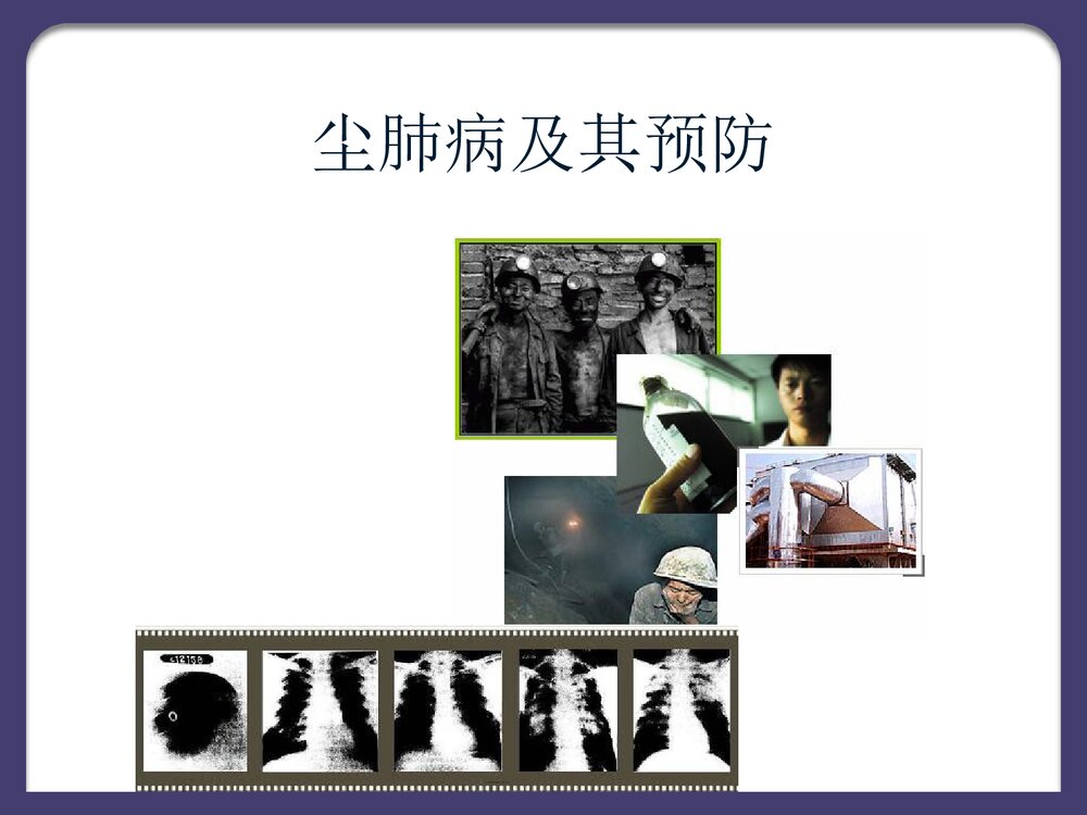 尘肺病及其预防PPT课件下载2