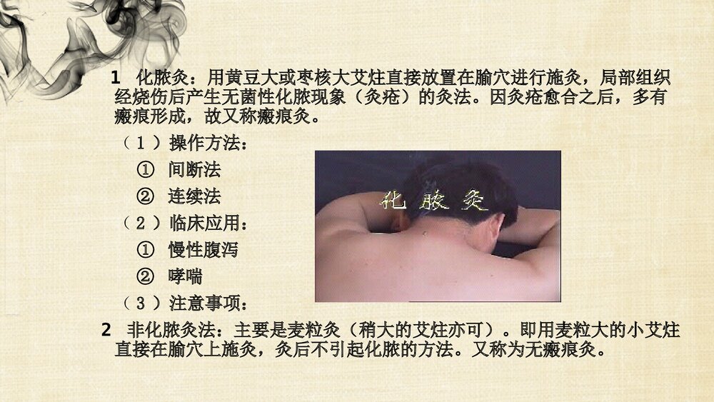 (刺法灸法学)灸法和拔罐法PPT课件下载4