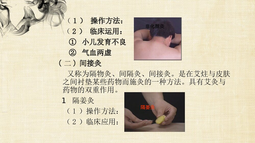 (刺法灸法学)灸法和拔罐法PPT课件下载5