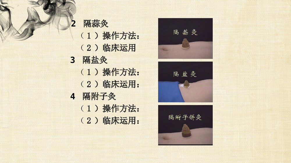 (刺法灸法学)灸法和拔罐法PPT课件下载6
