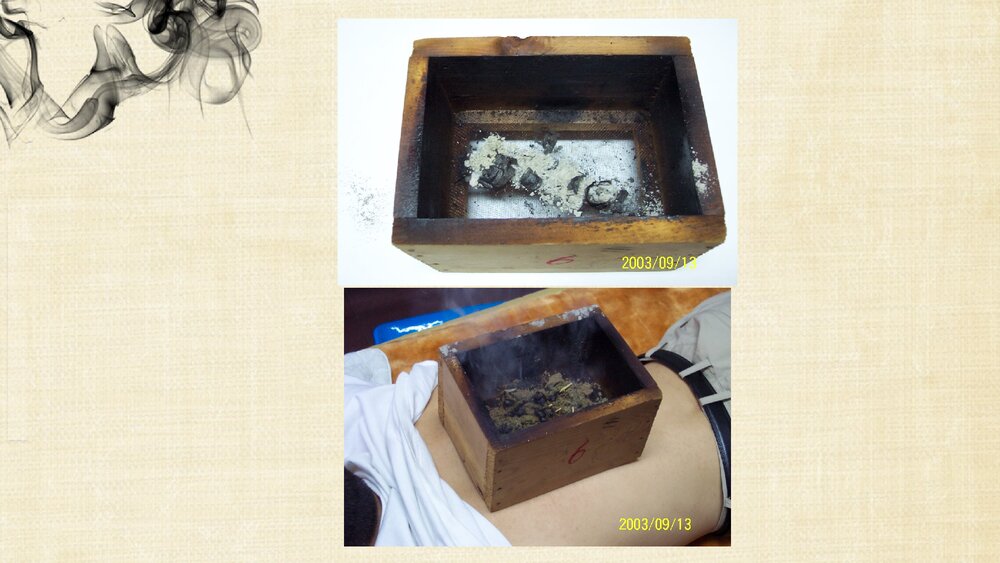 (刺法灸法学)灸法和拔罐法PPT课件下载10