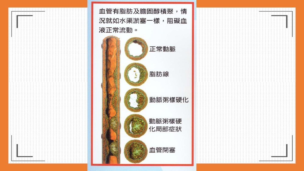 心脑血管疾病的预防及饮食调理PPT课件下载8