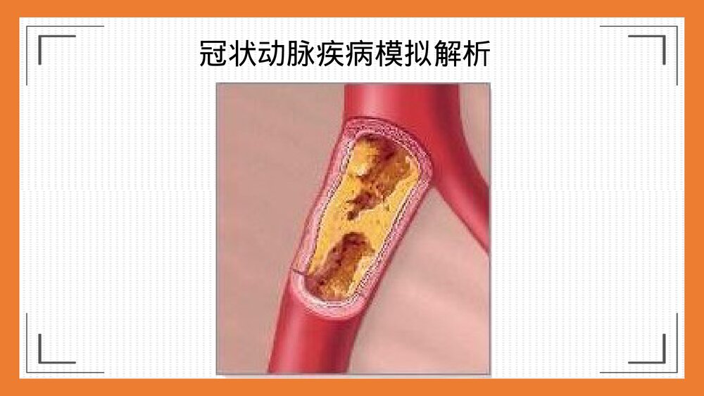 心脑血管疾病的预防及饮食调理PPT课件下载9