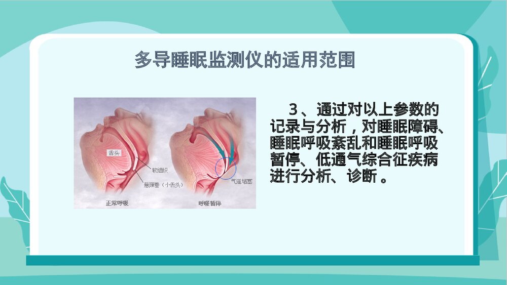 多导睡眠监测的护理PPT课件8