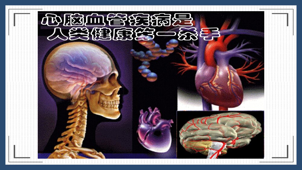 心脑血管疾病销售方案PPT课件下载6