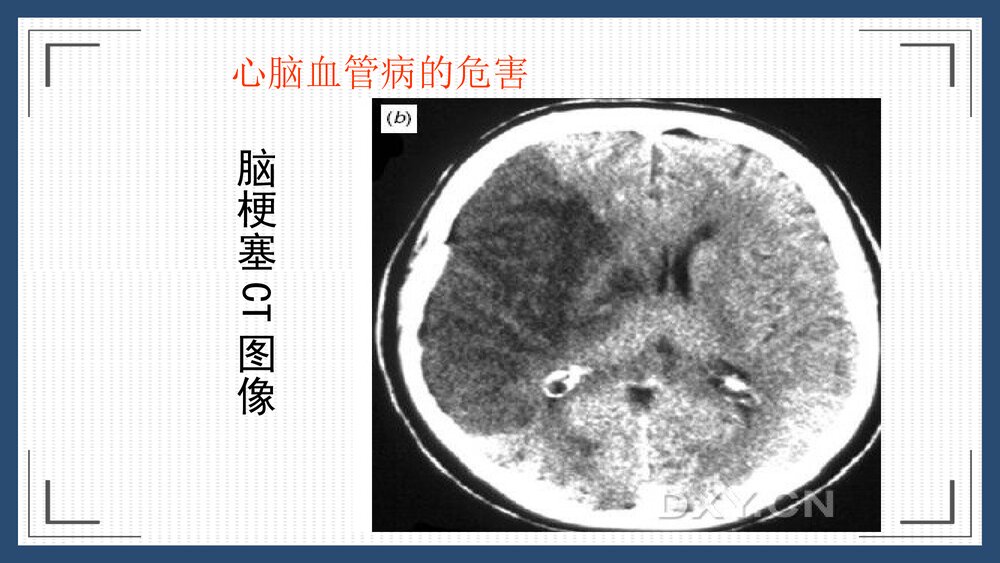 心脑血管疾病销售方案PPT课件下载10