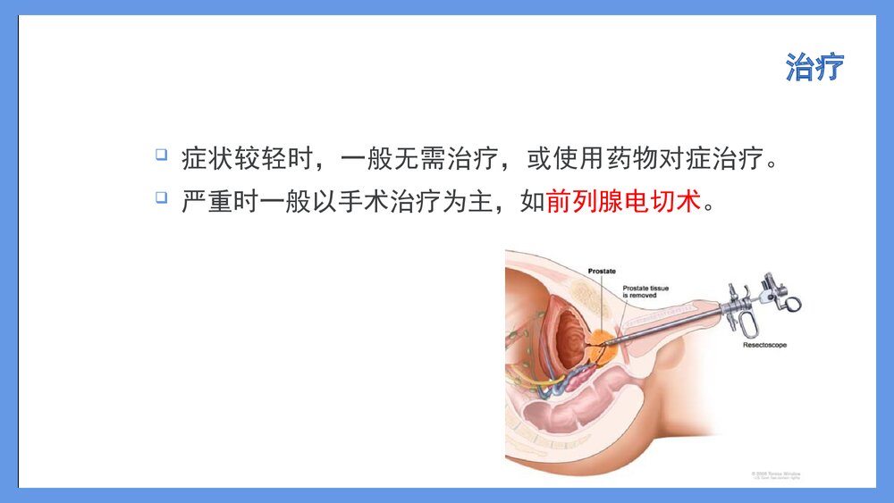前列腺电切术后的护理PPT课件下载5