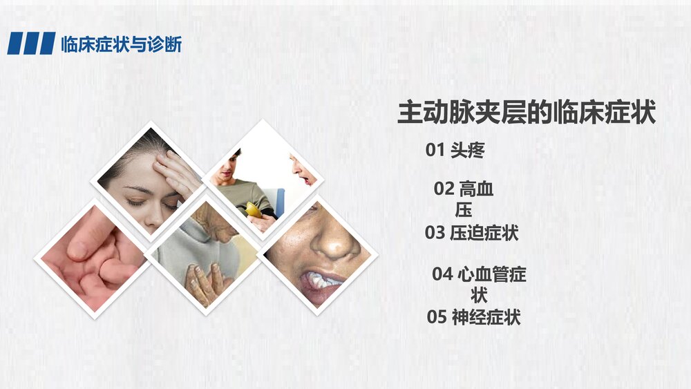 主动脉夹层急救护理PPT课件下载9