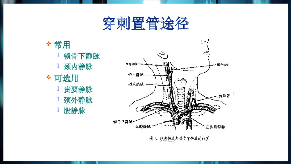中心静脉置管术PPT课件下载6