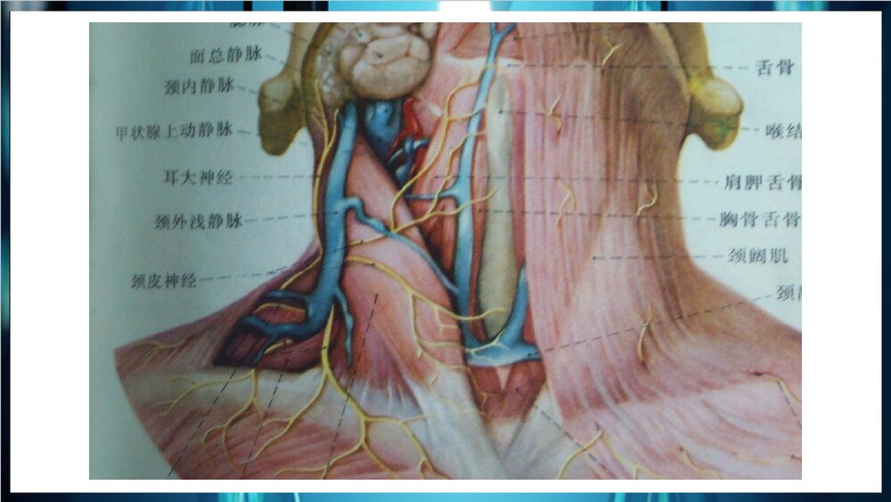 中心静脉置管术PPT课件下载9