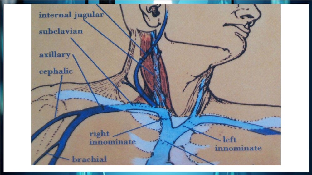 中心静脉置管术PPT课件下载10