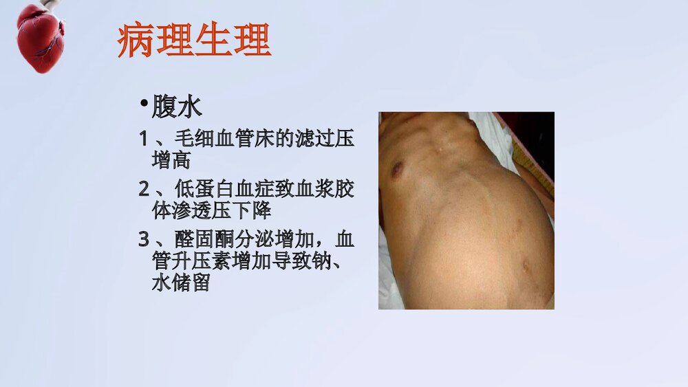 门静脉高压症病人护理PPT课件下载10