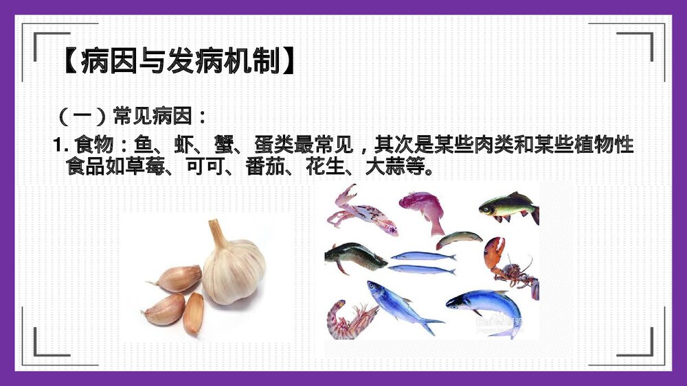 荨麻疹护理PPT课件下载3