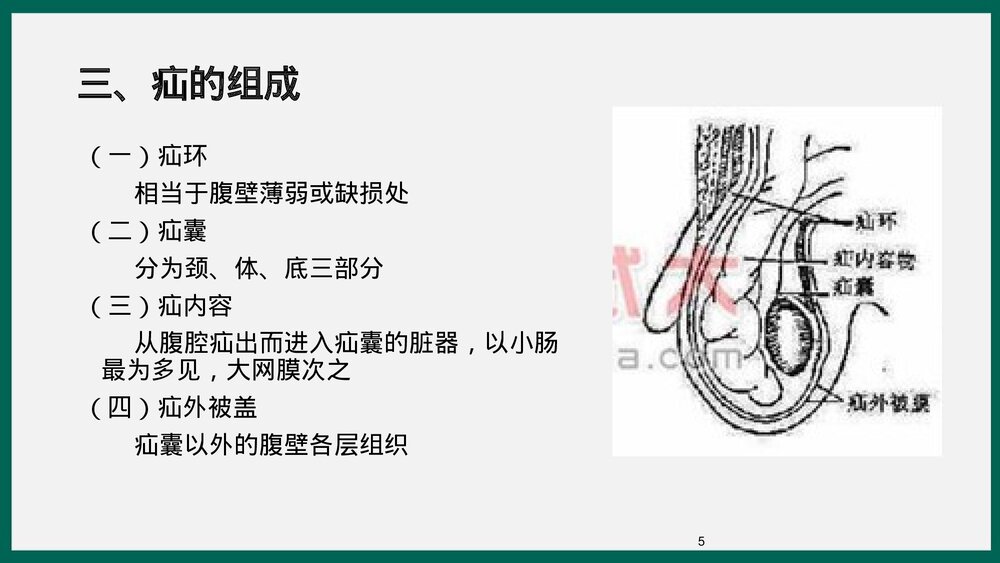 腹股沟疝业务学习PPT课件下载5
