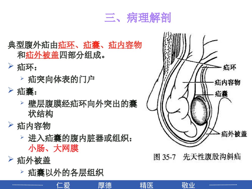 腹外疝病人的护理PPT课件5