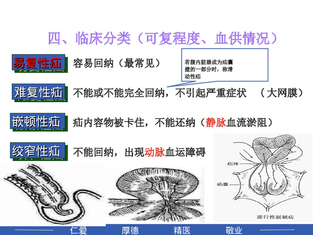 腹外疝病人的护理PPT课件6