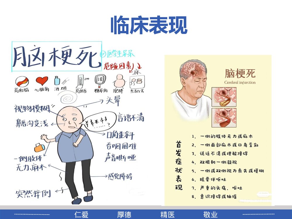 脑梗死患者的教学查房PPT课件6
