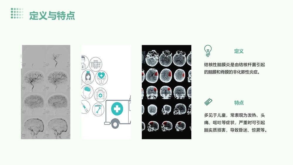 结核性脑膜炎的护理查房PPT课件下载4