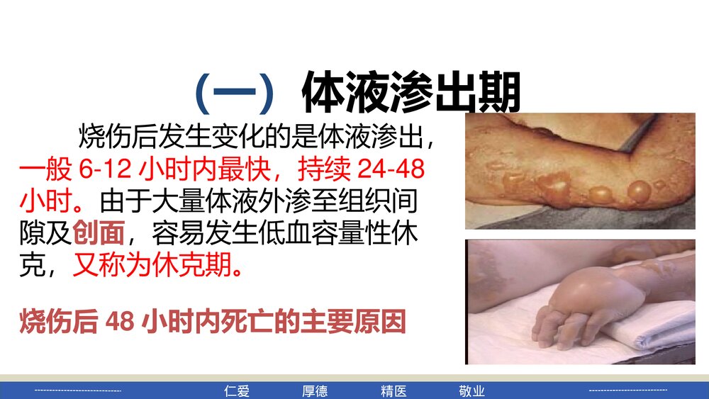 烧伤病人的护理PPT课件下载4
