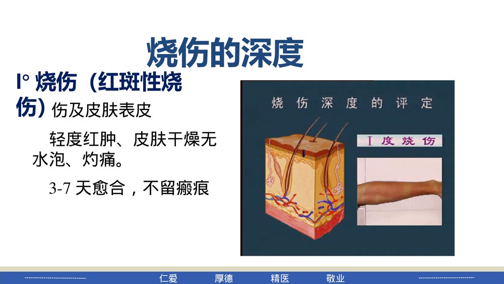 烧伤病人的护理PPT课件下载10
