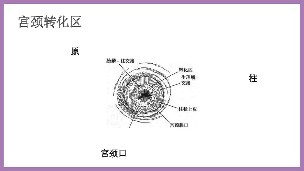 宫颈癌培训泡泡堂课件下载6