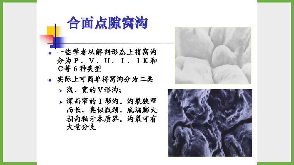 儿童窝沟封闭项目简介PPT课件4