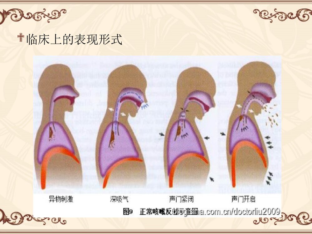 咳嗽咳痰PPT课件下载6