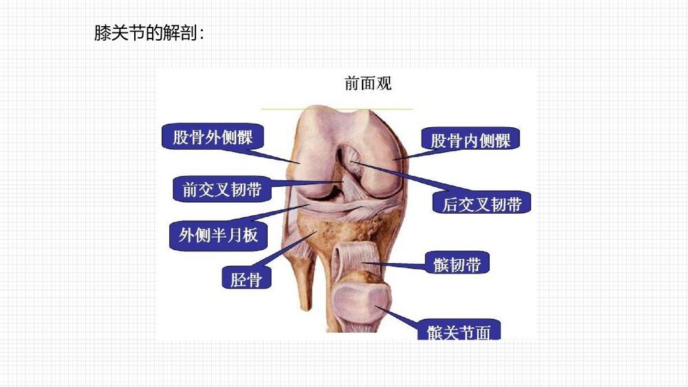 人工膝关节表面置换术护理查房PPT课件4