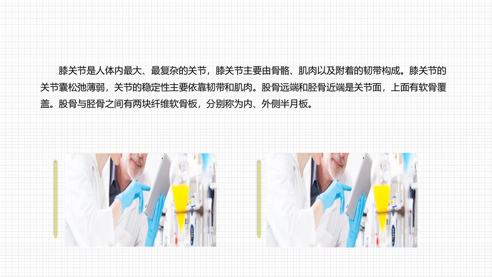 人工膝关节表面置换术护理查房PPT课件5