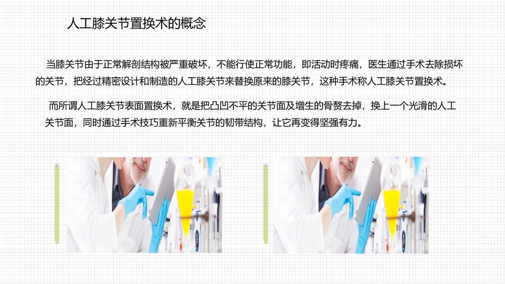 人工膝关节表面置换术护理查房PPT课件7